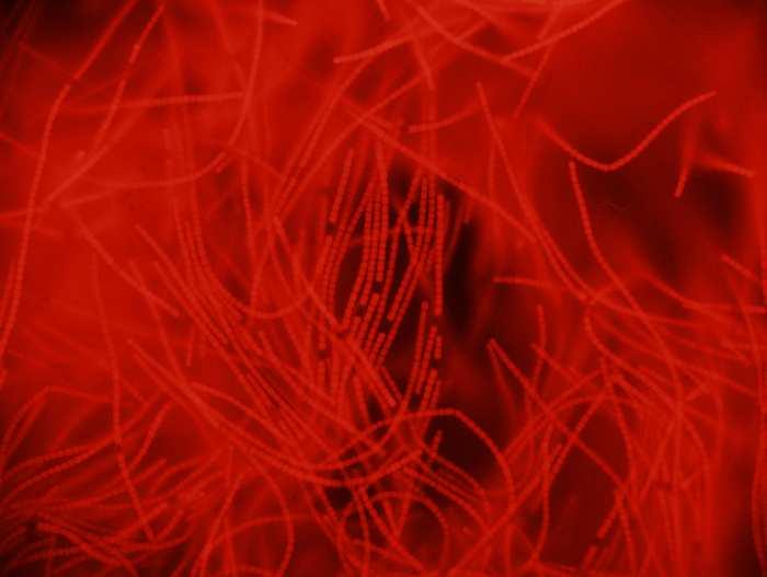 Image17-k5-anabaena